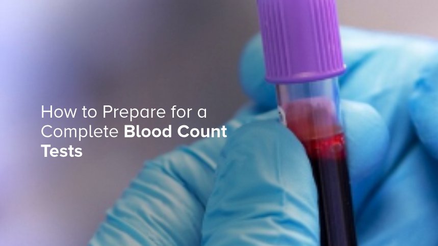 How to Prepare for a Complete Blood Count Test